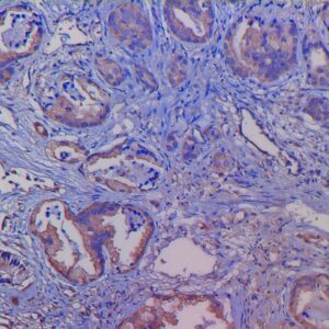 Anti-CD105 (Endoglin)