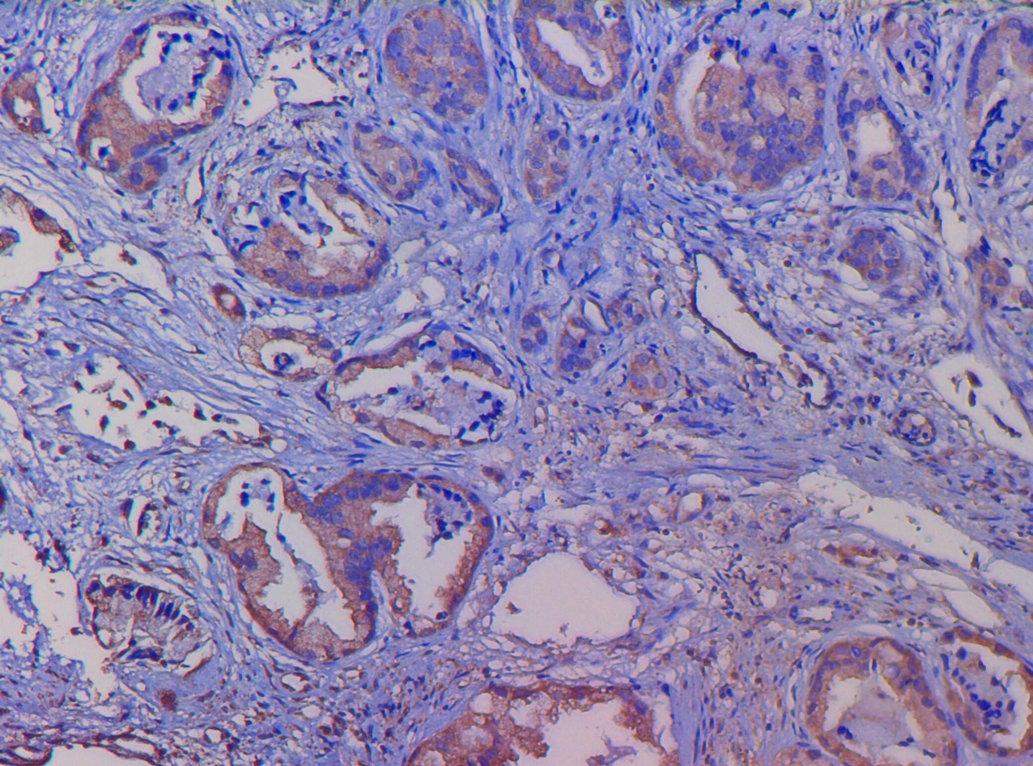Anti-CD105 (Endoglin)