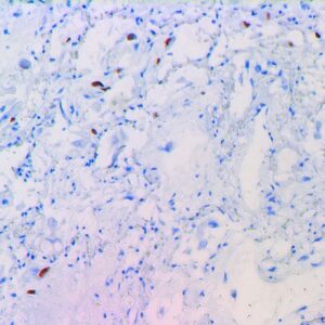 Anti-Cytomegalovirus (CMV)