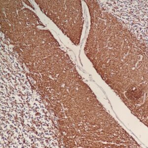 Anti-CD56, Clone 123A8