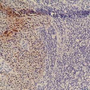 Anti-p16, Clone 16p04