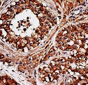 Anti-Inhibin, alpha (INHA), Clone INHA/4265