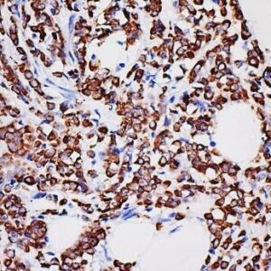 Anti-Cytokeratin 18, Clone MSLN/2131