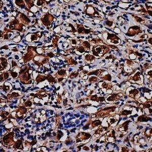 Anti- IDH1, Clone IDH1/1152