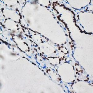 Anti-TTF-1, Clone NX2.1/690