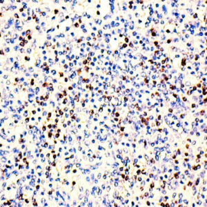 Anti-Perforin, Clone PRF1/2470