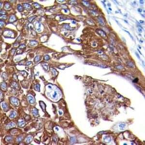 Anti-Cytokeratin PAN, CloneAE-1/AE-3