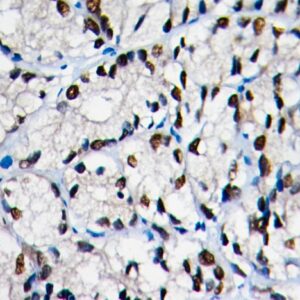 Anti-NKX3.1 , Clone NKX3.1