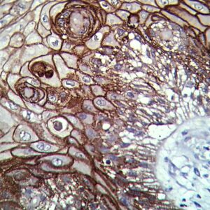 Anti-Desmoglein-3, Clone DSG3/2839