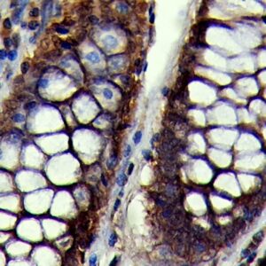 Anti-Anti-IL-1a, Clone IL1A/3981