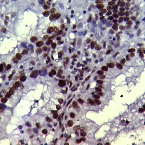 Anti-INI-1, Clone A-5