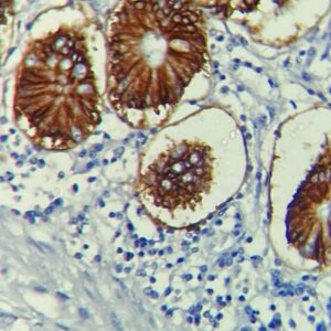 Anti-LI-cadherin/CDH17, Clone CAEX3