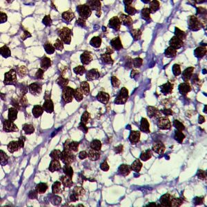 New Improved Super Sensitivetm Polymer HRP IHC Detection For NanoVIP