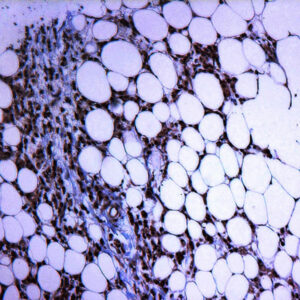 Anti-Estrogen Receptor beta 1, Clone[ERb455]