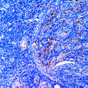 Anti-Granzyme B, Clone2C5