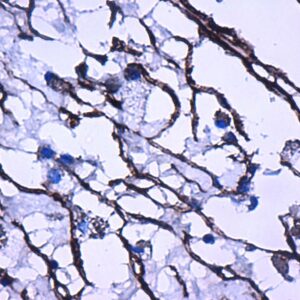 Anti-NGF-Receptor (p57)/ CD271