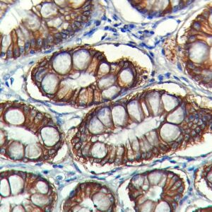 Anti-LI Cadherin/ Cadherin 17