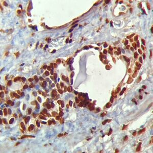 Anti-INI1/SNF5/SMARCB1