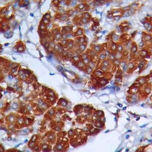 Anti-Alpha 1-Antichymotrypsin(AACT/1451)