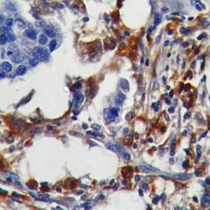 Anti-Cathepsin K(CTSK/2791)