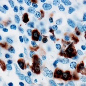 Anti-Human Lambda Light Chain [EP172]