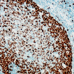 Anti-Human Ki-67 [EP5]