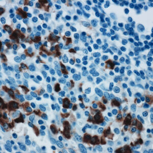 Anti-Human Lambda Light Chain [SP147]