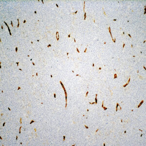 Anti-CD34 (Endothelial Cell)