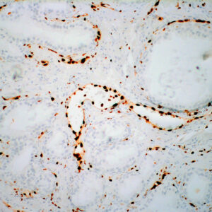 Anti-ERG, Ets-Related Gene