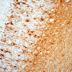 Anti-Glial Fibrillary Acidic Protein (GFAP)