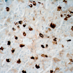 Anti-Human Luteinizing Hormone [SP132]