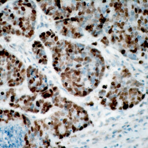 Anti-Topoisomerase II, Alpha (TOP2A)