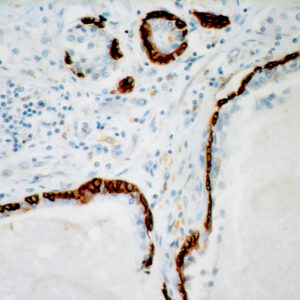 Anti-Cytokeratin 14