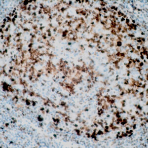 Anti-Human MCM2 [EP40]