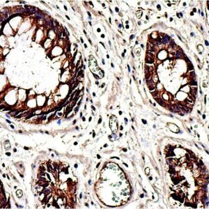 Anti-Beta-catenin, Clone Polyclonal