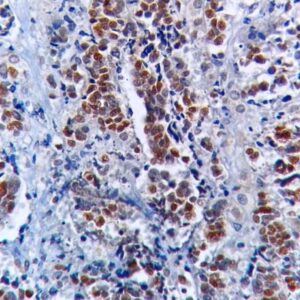 Anti-INSM1(INSM1/6286R)