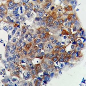 Anti-Mammaglobin (MGB/4811R)