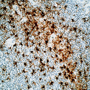 Anti-Glial Fibrillary Acidic Protein (GFAP)