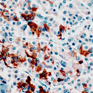 Anti-Thyroid Stimulating Hormone (TSH)