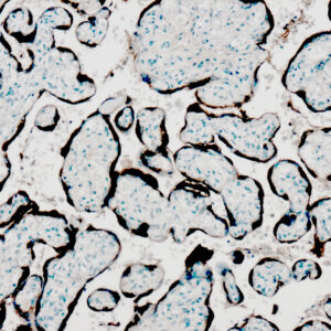 Anti-Placental Lactogen (hPL)