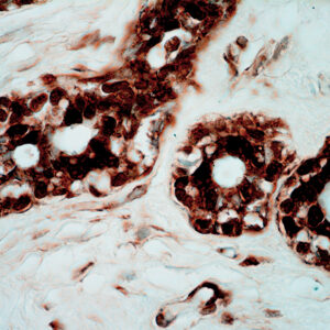 Anti-Glutathione S-Transferase Pi (GST Pi)