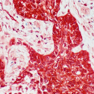 Anti-Platelet-Derived Growth Factor (PDGF)