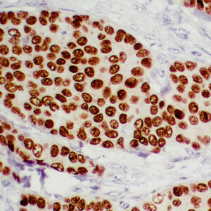 Anti-Estrogen Receptor (ER) Beta