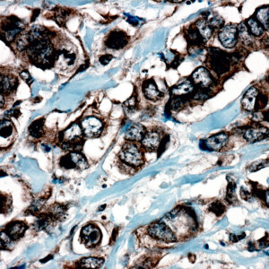 Anti-Catenin Delta 1 (P120)