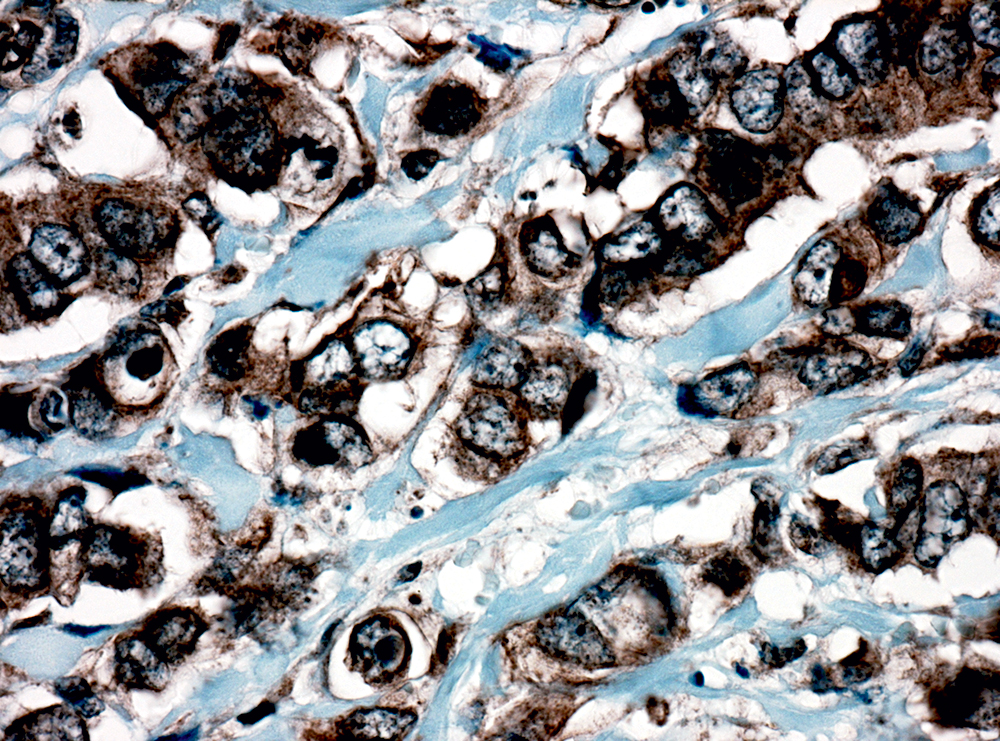 Anti-Catenin Delta 1 (P120)