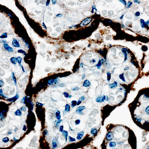 Anti-human Growth Hormon (hGH)