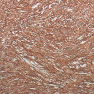 Anti-CD117/c-Kit/SCF-Receptor