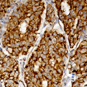 Anti-Beta-Catenin (p120), Clone CTNNB1/1507
