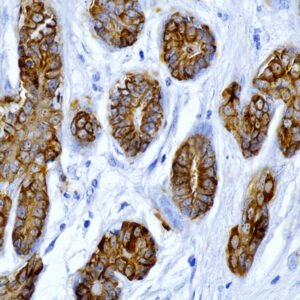 Anti-Cytokeratin , Clone [CAM 5.2]