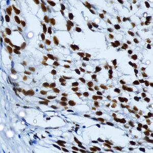 Anti-Histone H3 [PHH3/471R]